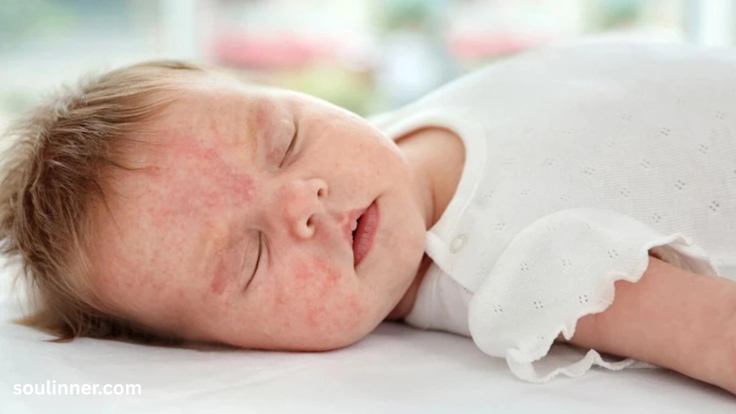 angel kiss birthmark spiritual meaning