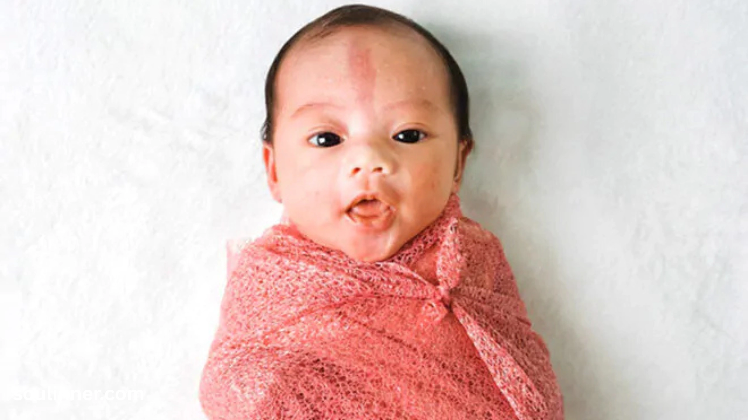 angel kiss birthmark spiritual meaning