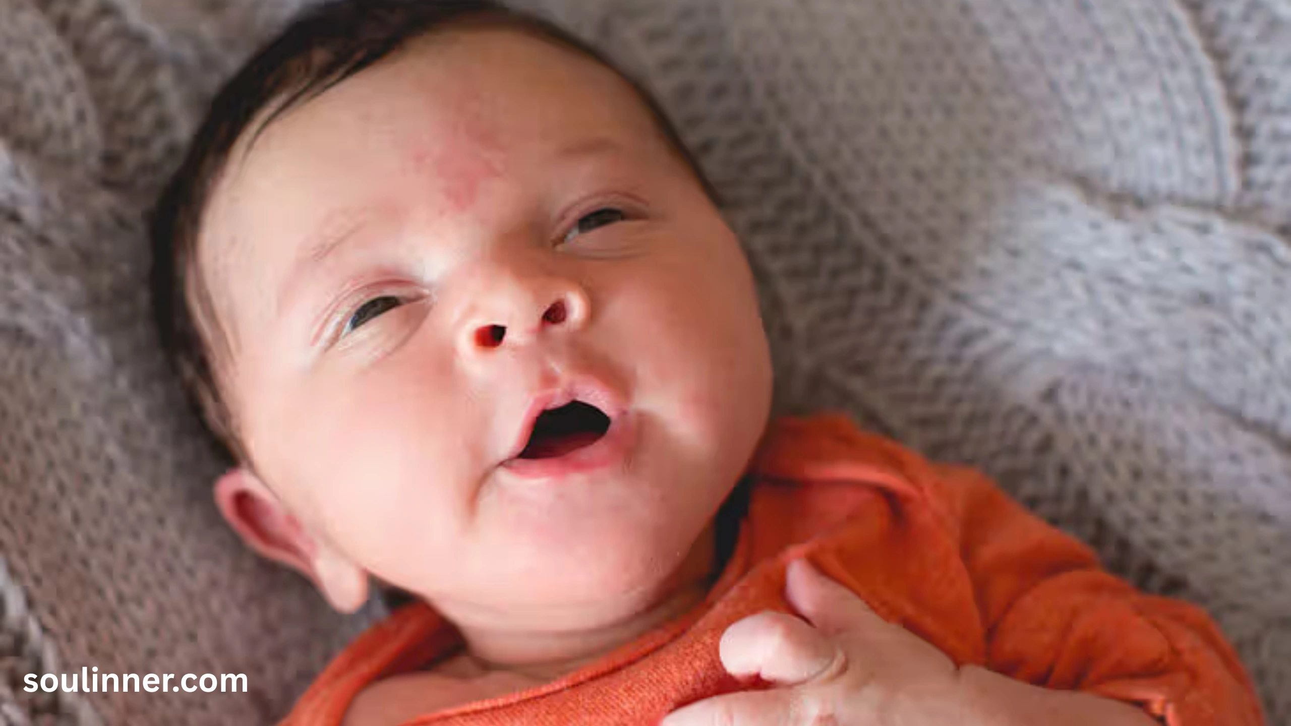 angel kiss birthmark spiritual meaning