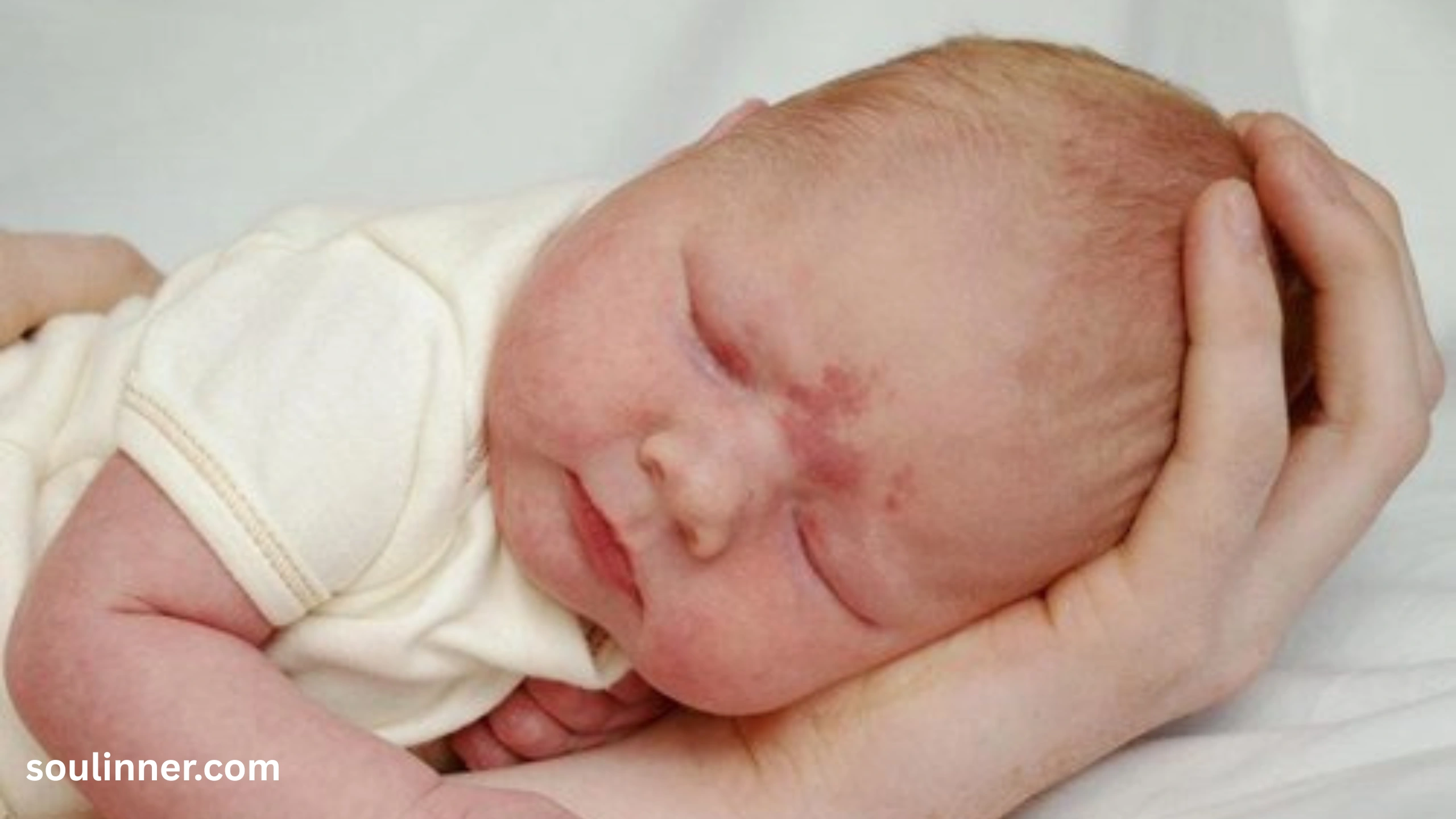 angel kiss birthmark spiritual meaning