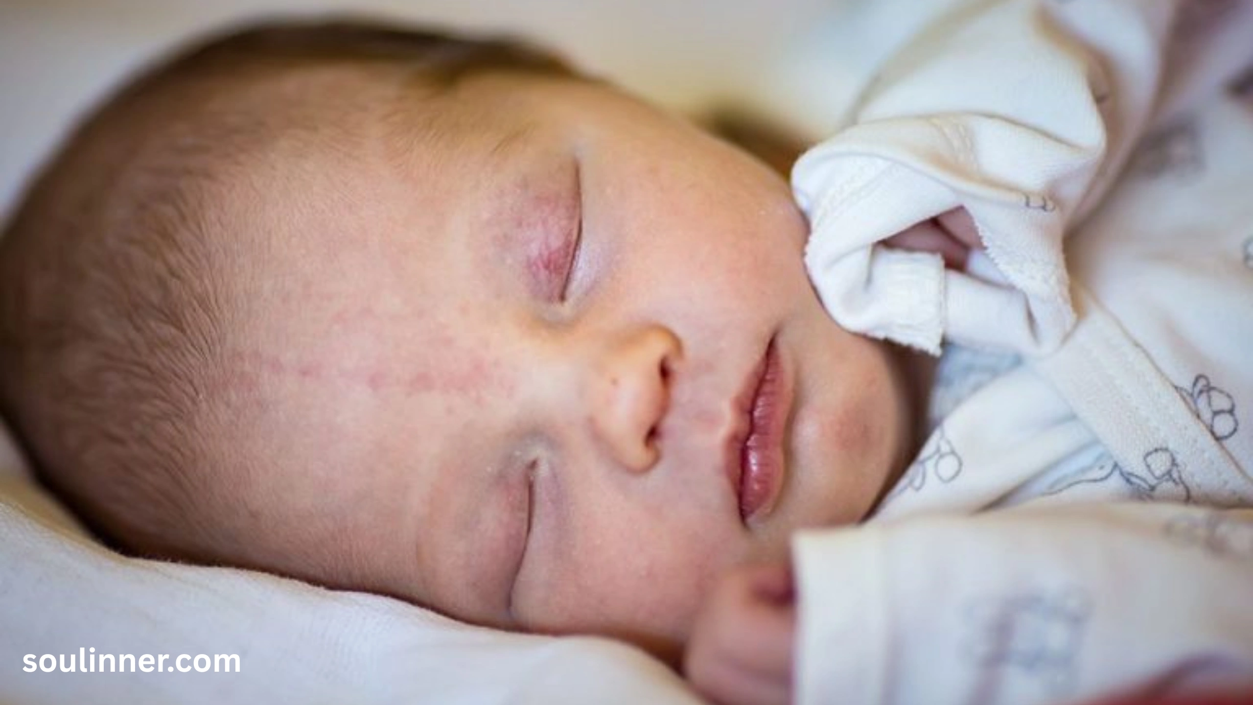 angel kiss birthmark spiritual meaning