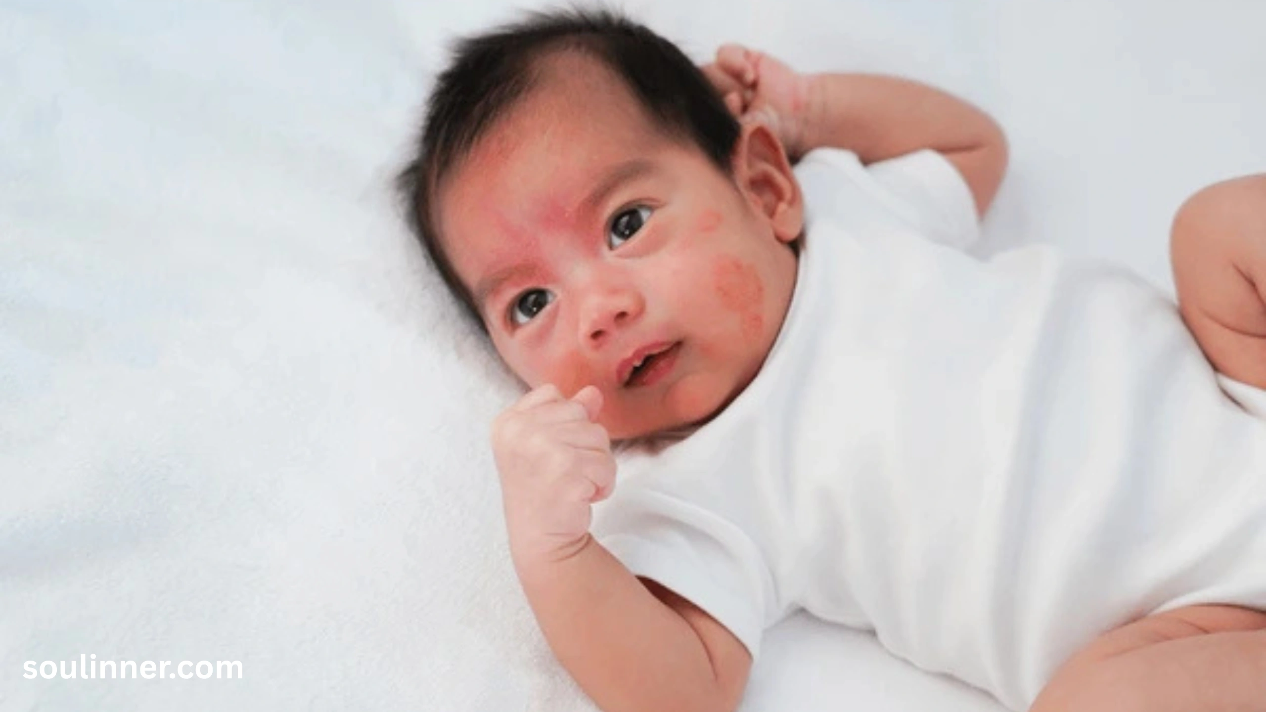 angel kiss birthmark spiritual meaning