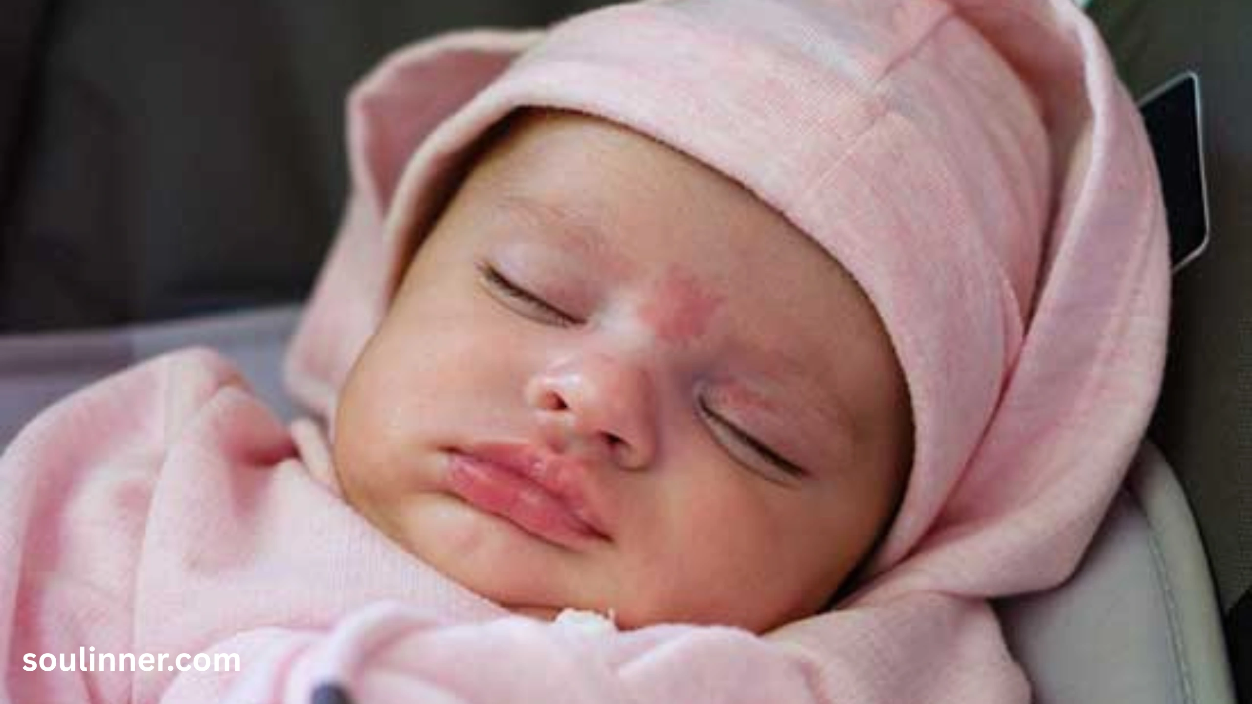 angel kiss birthmark spiritual meaning