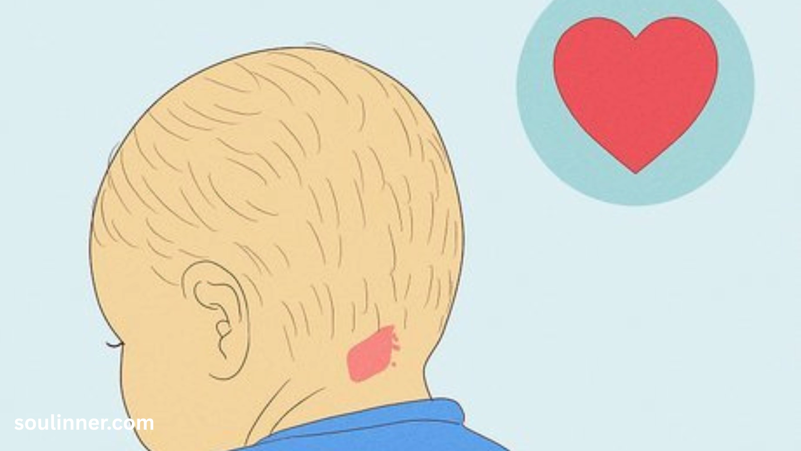 angel kiss birthmark spiritual meaning