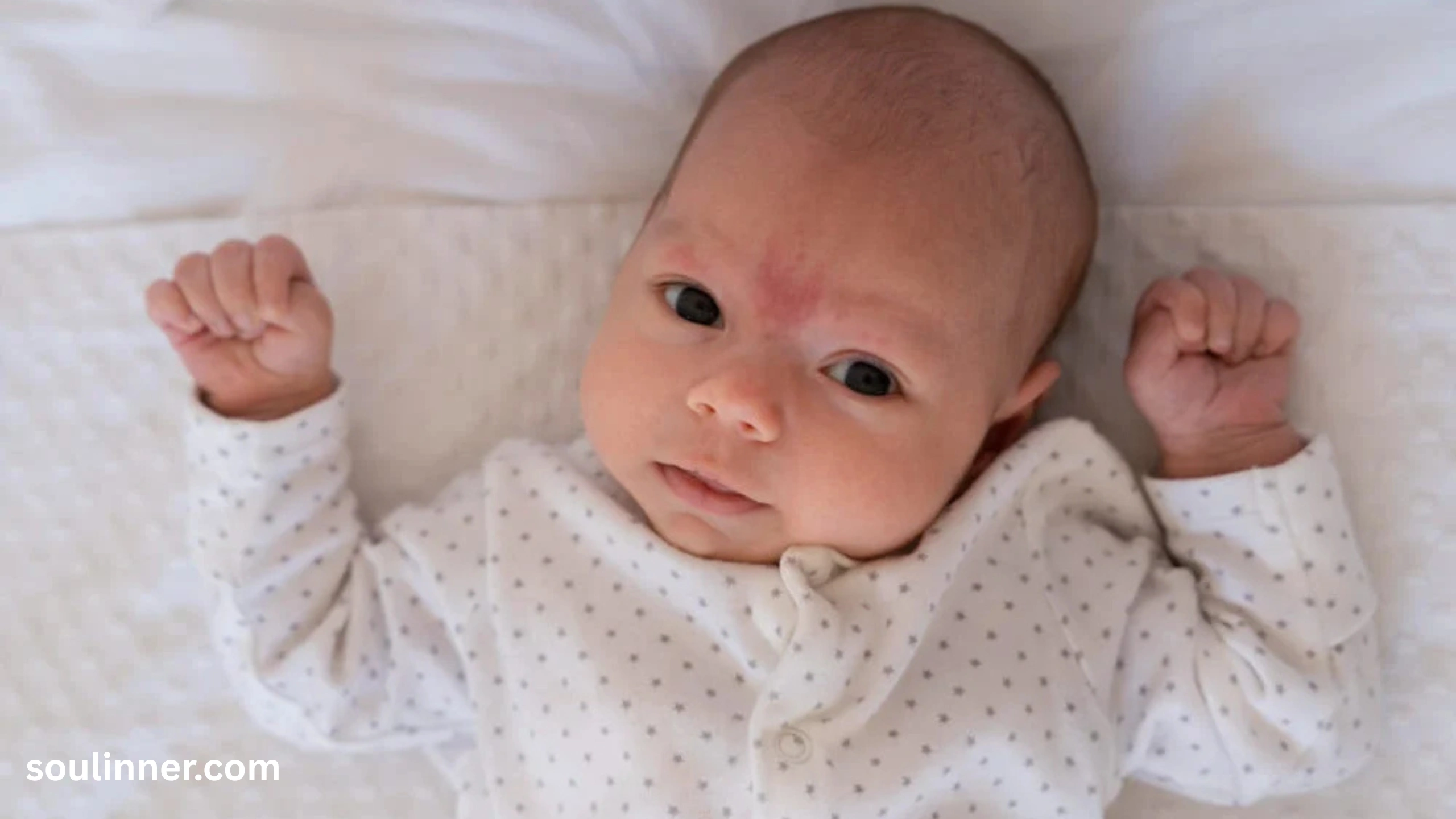 angel kiss birthmark spiritual meaning