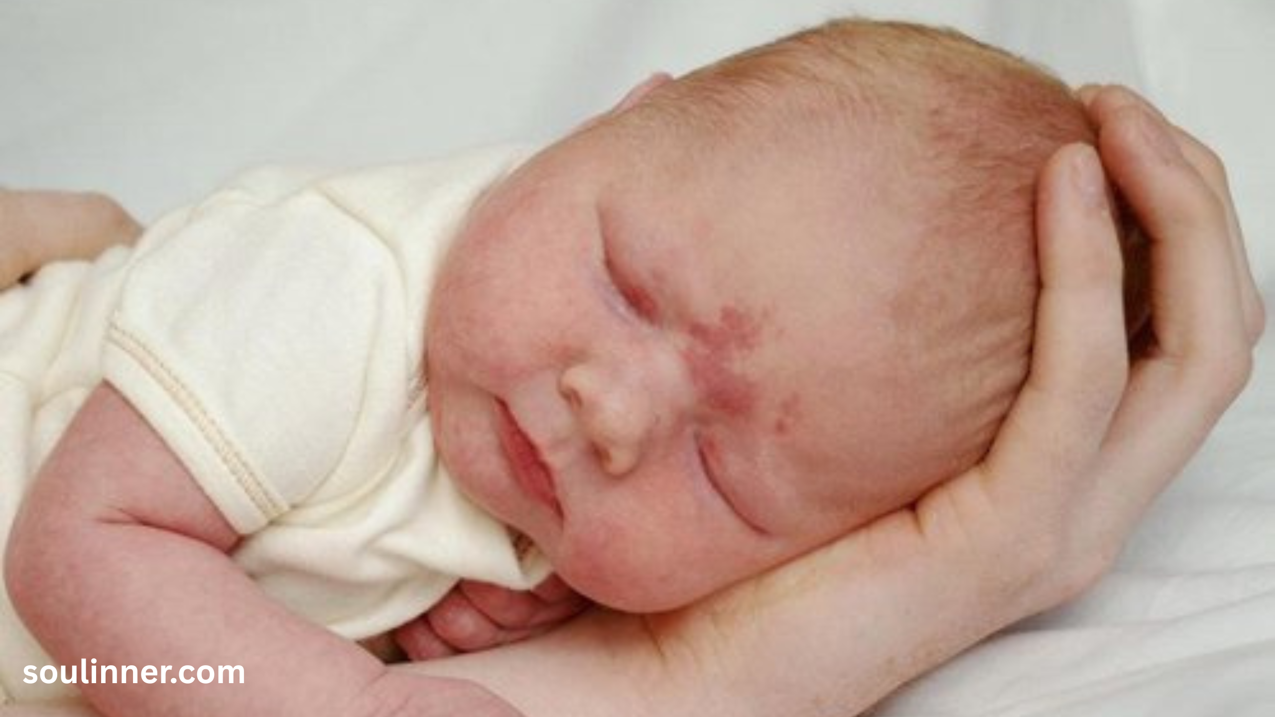 angel kiss birthmark spiritual meaning