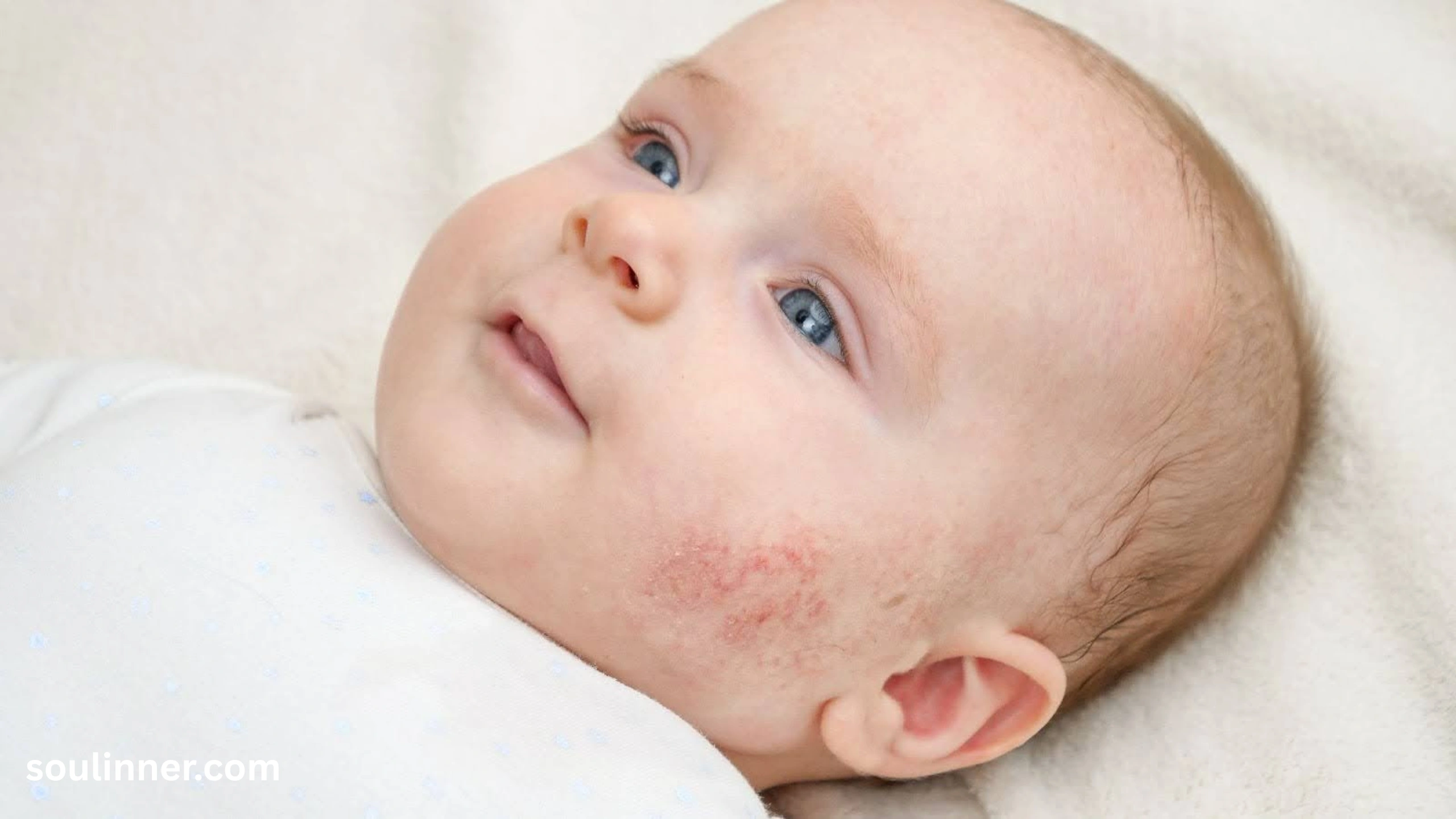 angel kiss birthmark spiritual meaning