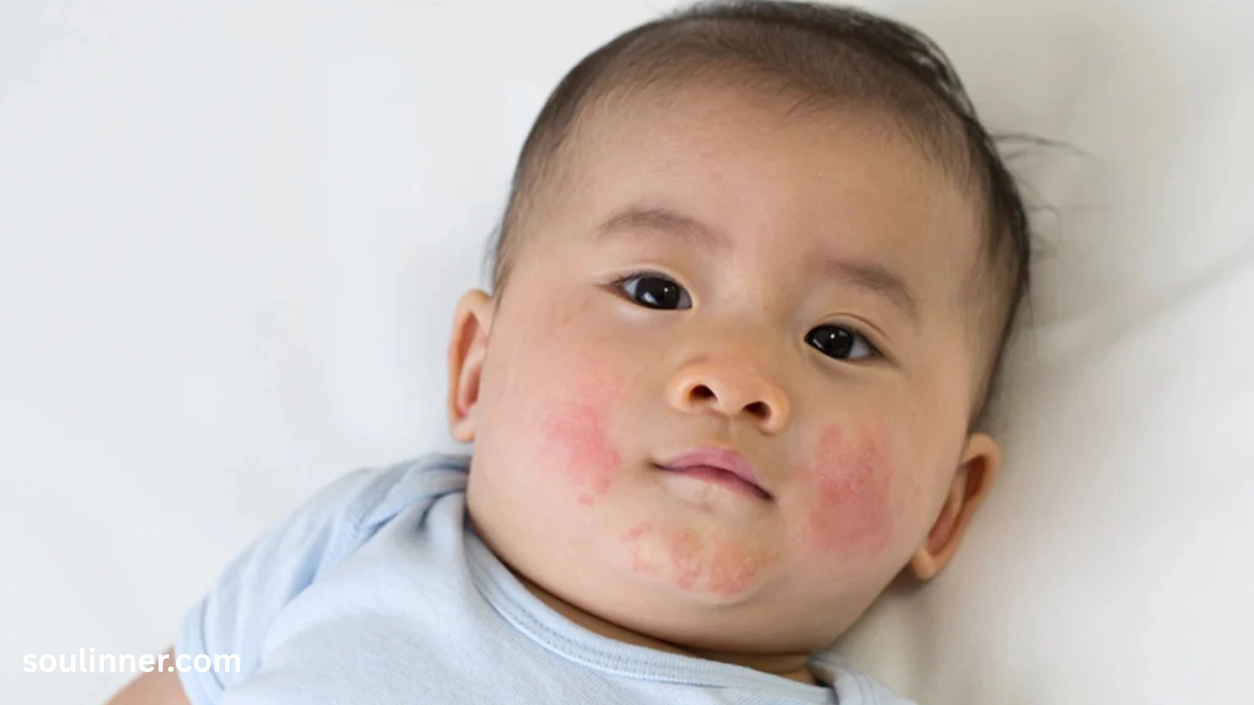 angel kiss birthmark spiritual meaning