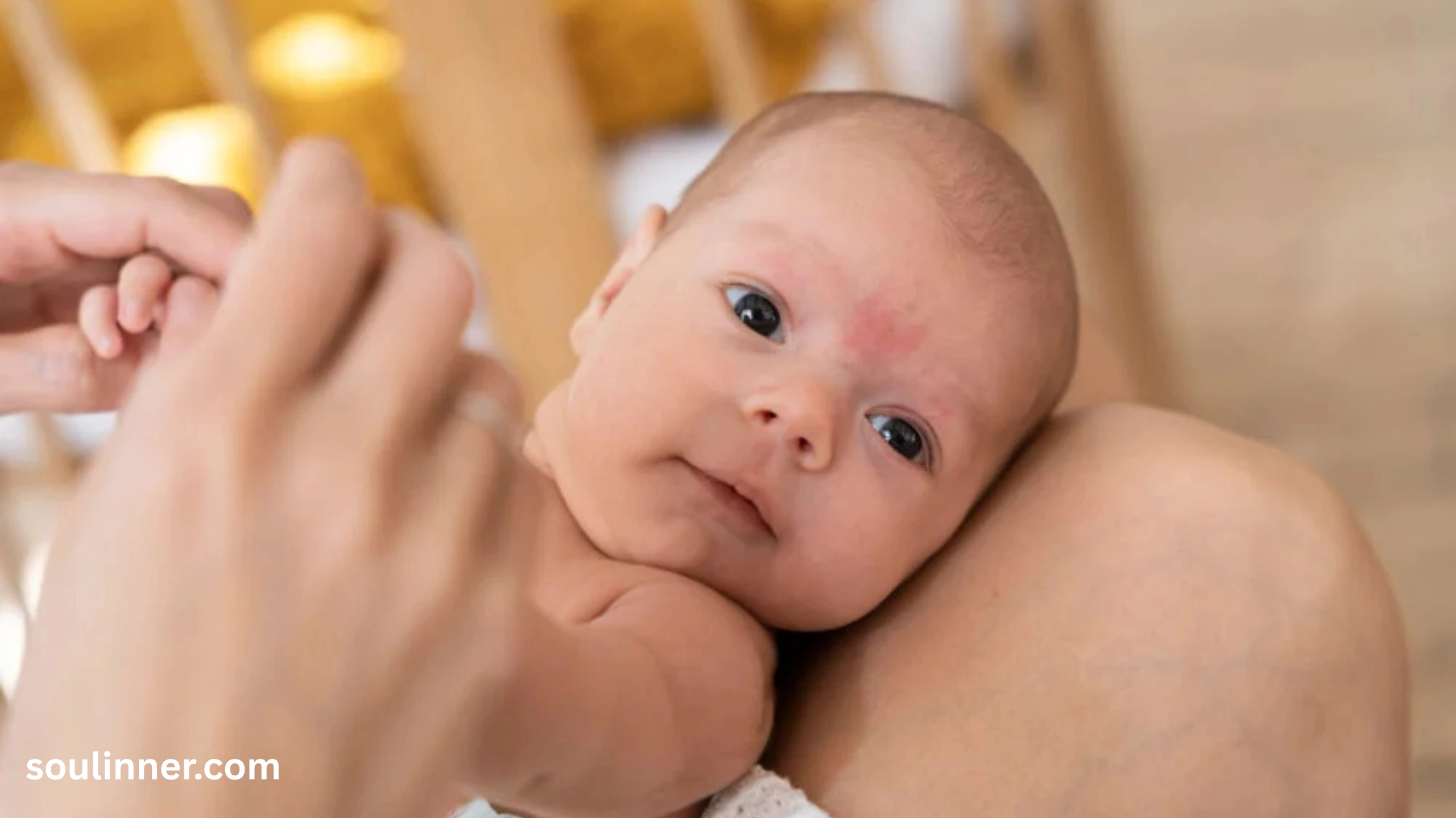 angel kiss birthmark spiritual meaning