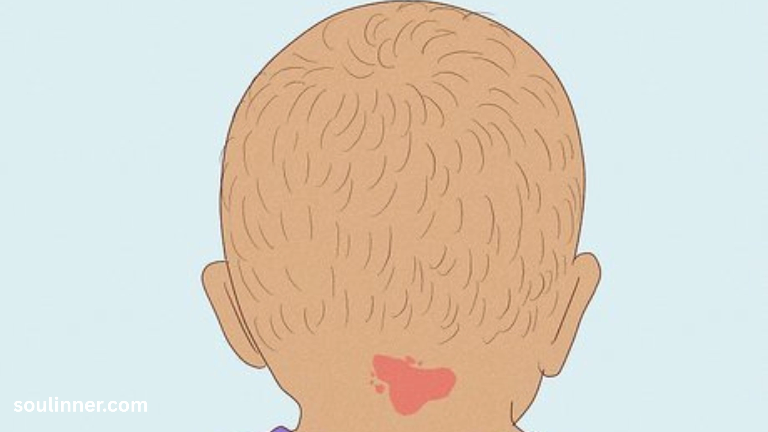 angel kiss birthmark spiritual meaning