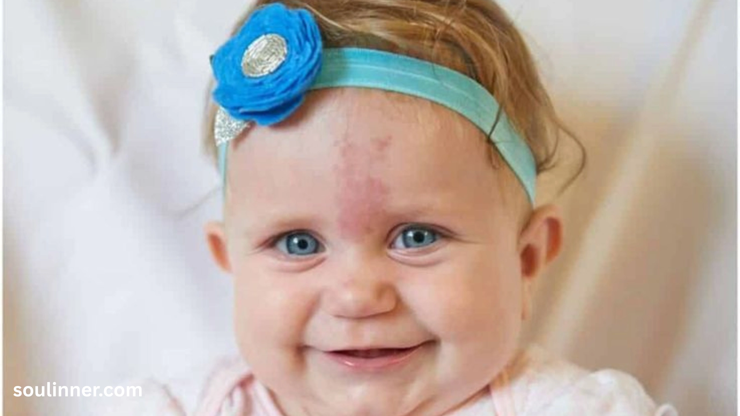 angel kiss birthmark spiritual meaning