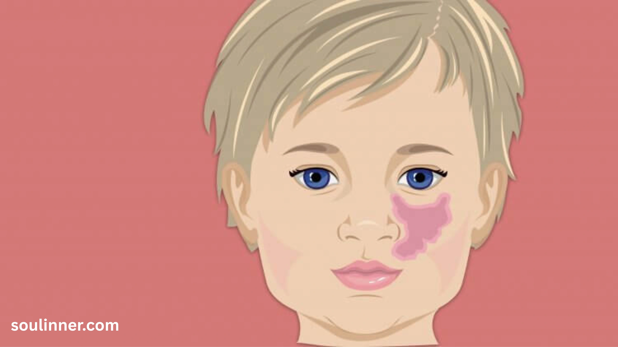 angel kiss birthmark spiritual meaning