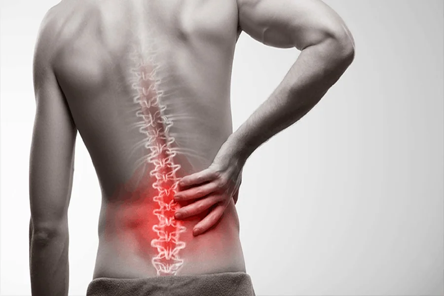 Sciatica